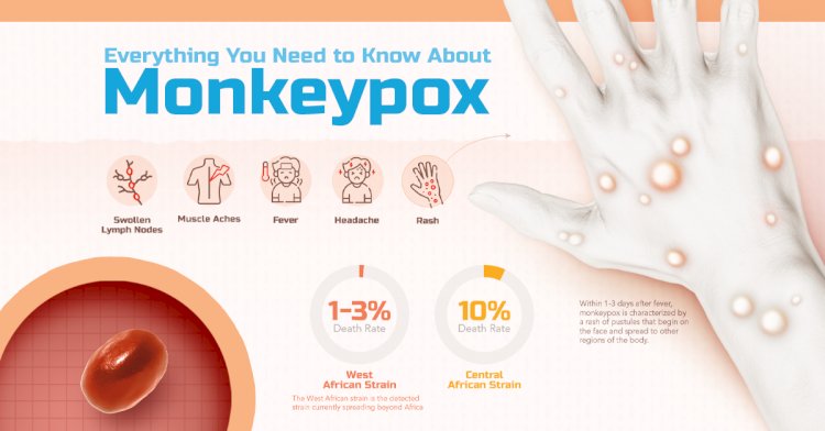 Monkeypox: Another Healthcare Emergency?